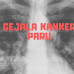 Gejala Kanker Paru + Infografis