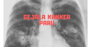 Gejala Kanker Paru + Infografis